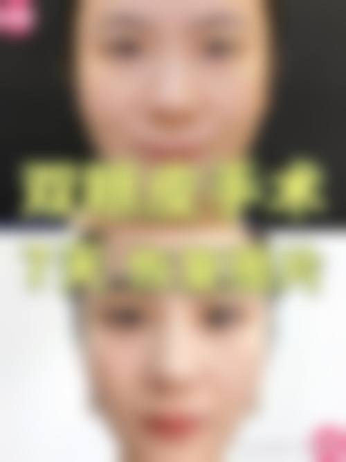 珠海六和医院整形美容收费价格表