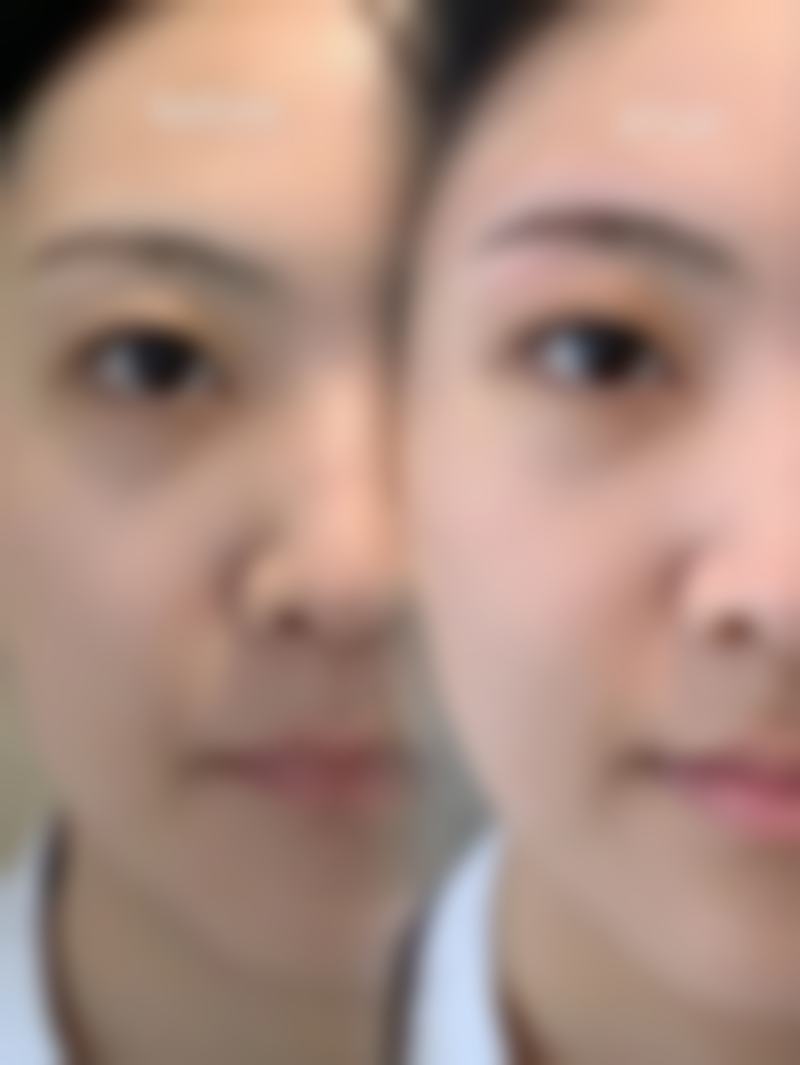 咸宁卓雅整形美容门诊部口碑怎么样