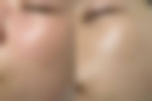 东莞美极医疗美容整形门诊部特色项目及技术优势
