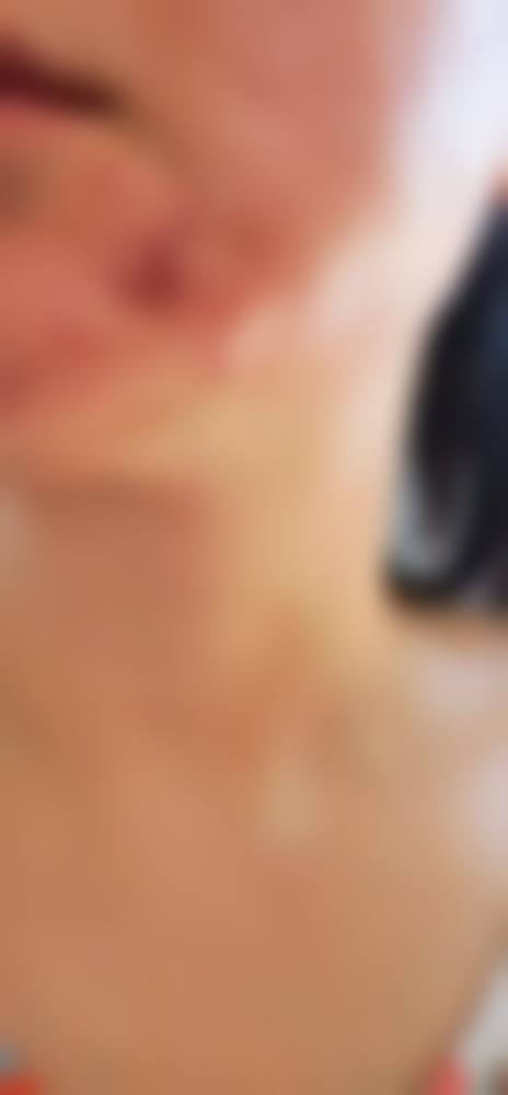 长春肤康医院是正规的吗/怎么样/靠谱吗