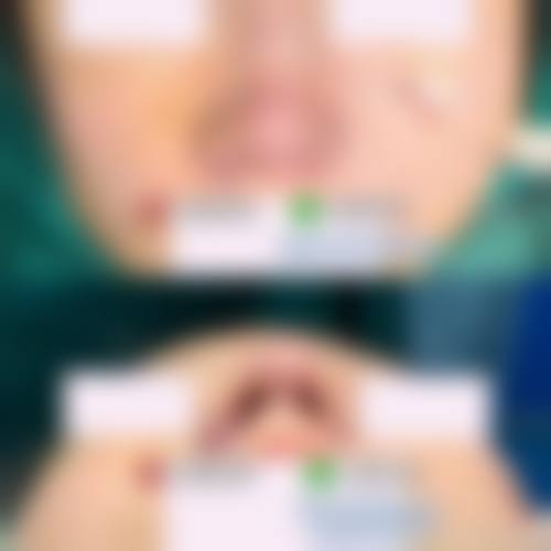 东莞美极医疗美容整形门诊部是正规的吗