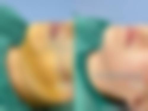 三、临床实战与真实实例