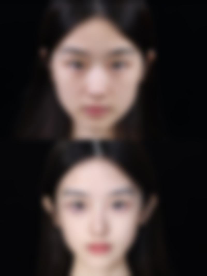 3. 金允熙的临床实战与真实实例
