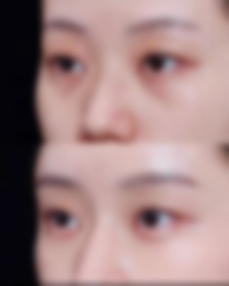 为什么要选择韩国济州岛slow整形外科?