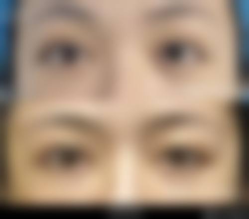 兰州韩美整形门诊部收费价格表