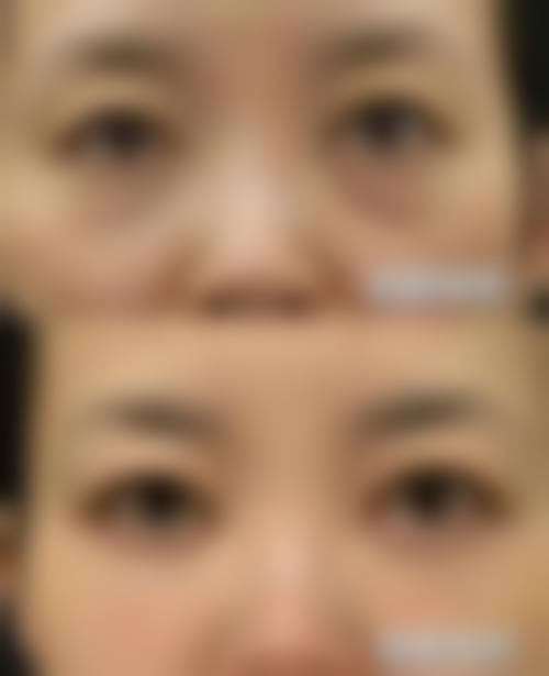 临沂泰盟整形医院收费价格表