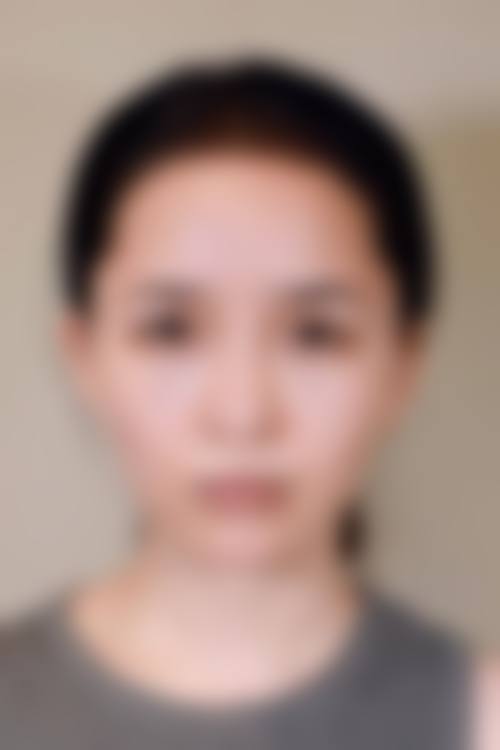 昆明悦美人医疗美容诊所口碑怎么样