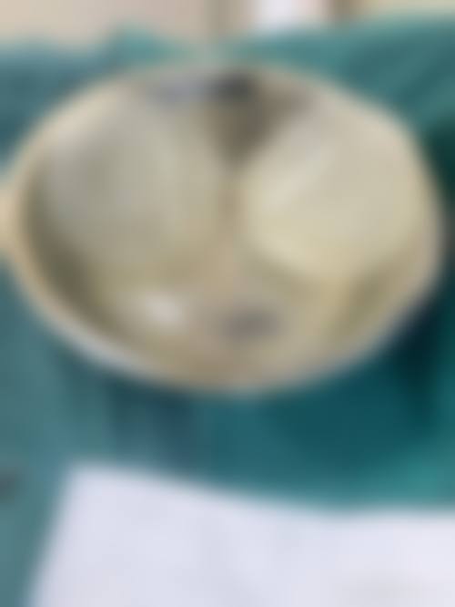 3. 韩崇熙的临床实战与真实实例