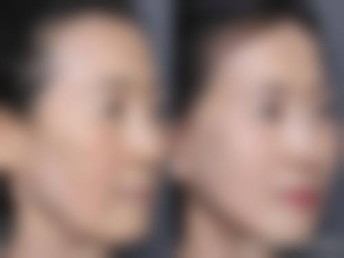 洛阳美丽宣言整形医院收费价格表