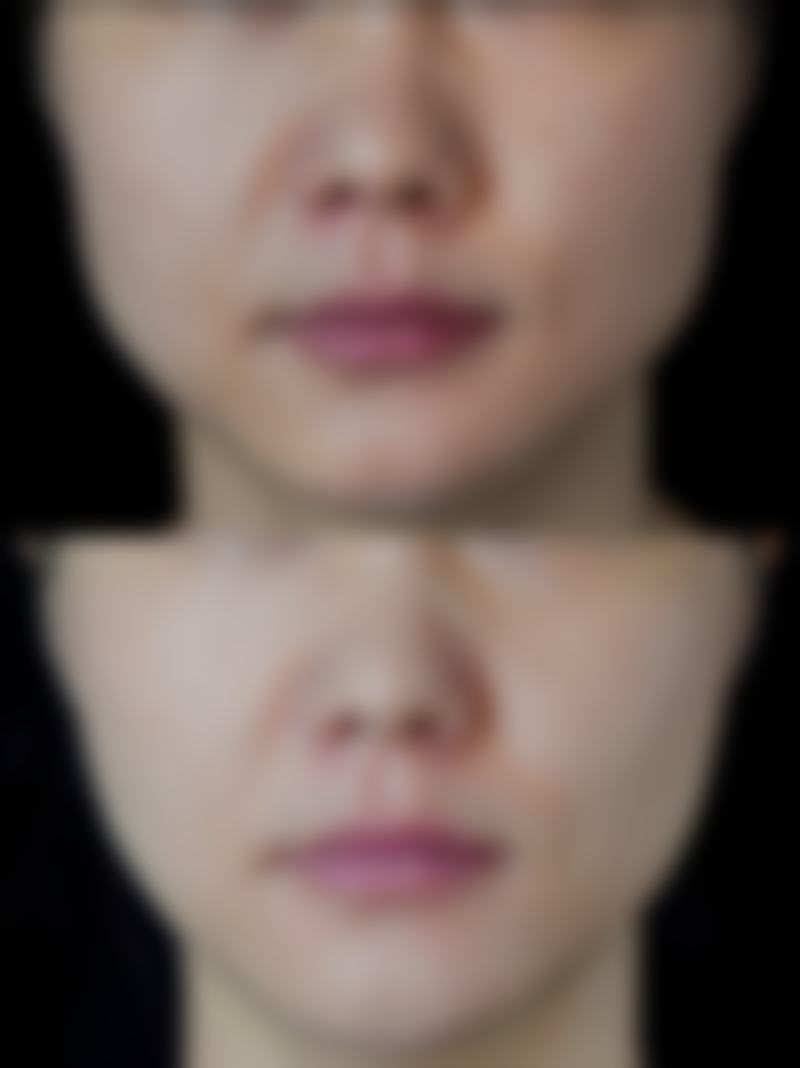昆明悦美人医疗美容诊所收费价格表