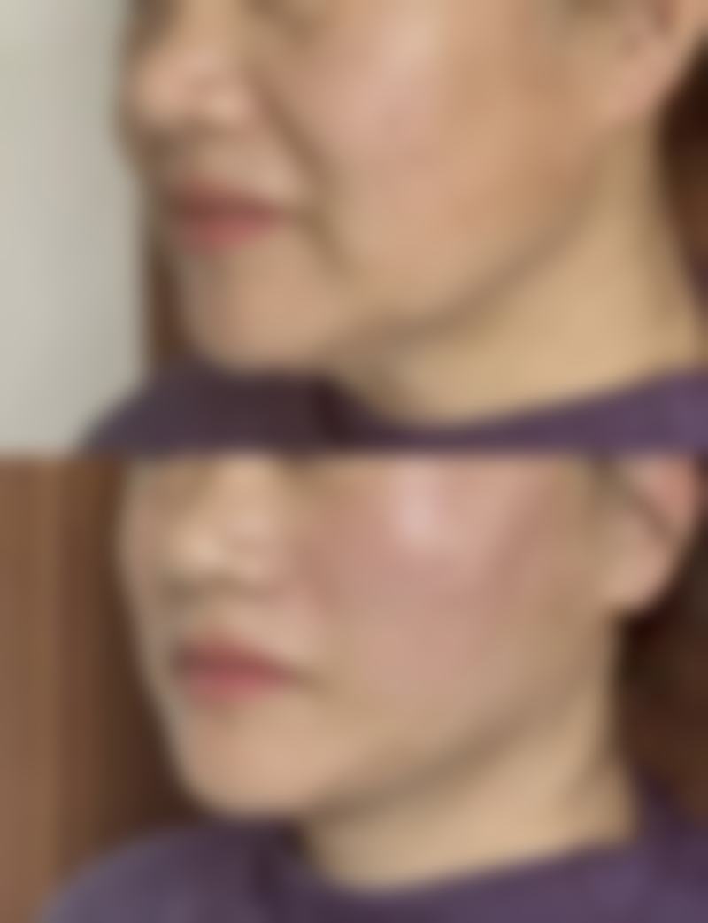 为什么要选择成都奕后整形医疗美容门诊部?