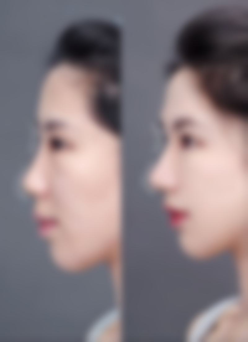 武汉爱美仕颜整形医院是正规的吗
