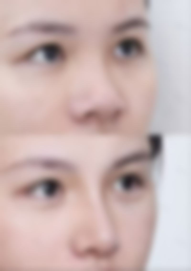 为什么要选择昆明悦美人医疗美容诊所?