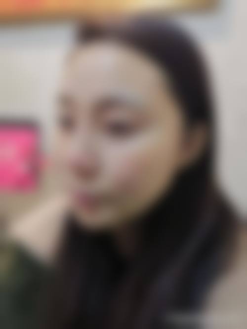 烟台鹏爱整形医院特色项目及技术优势