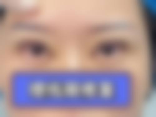 台州椒江薇阁整形医院是正规的吗/怎么样/靠谱吗