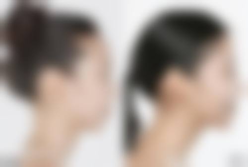 长沙南湖整形医院口碑怎么样