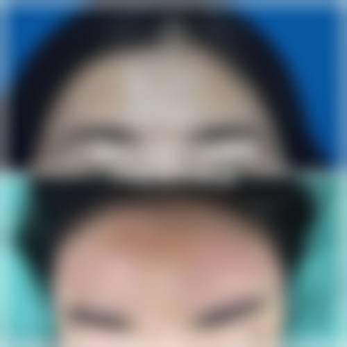 长沙南湖整形医院收费价格表
