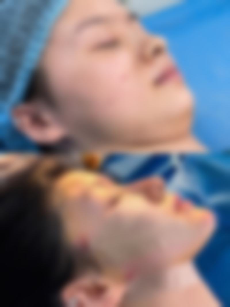Made U减肥药特色项目及技术优势