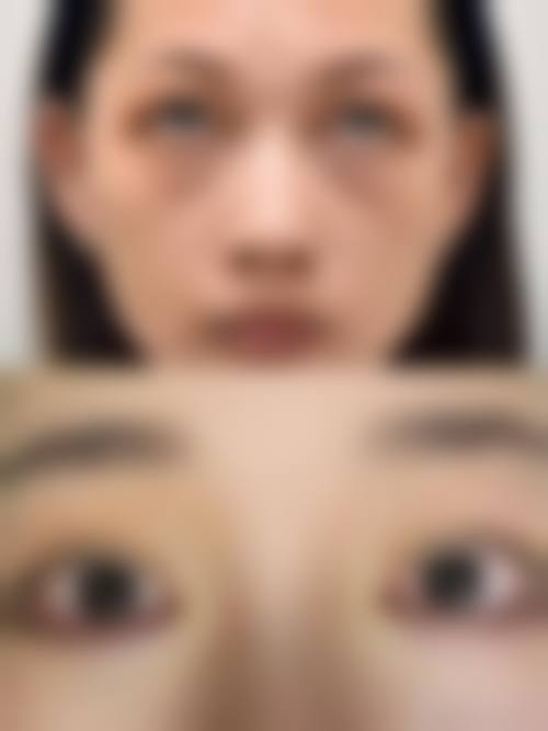 余干县优嘉整形医院是正规的吗