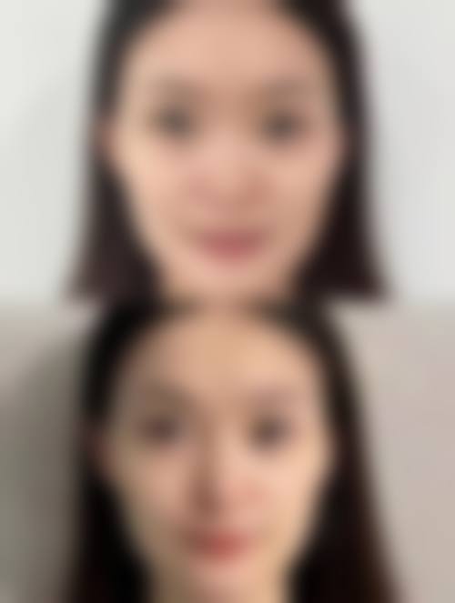 深圳瀞一医疗美容诊所是正规的吗