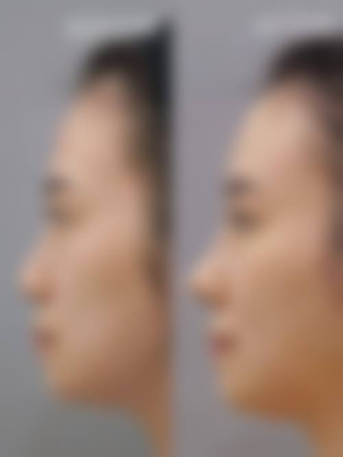 为什么要选择益阳格莱美整形医院?