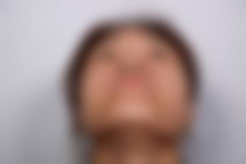 为什么要选择深圳瀞一医疗美容诊所?