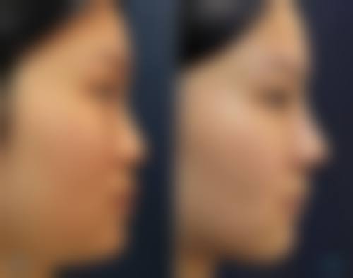 益阳格莱美整形医院特色项目及技术优势