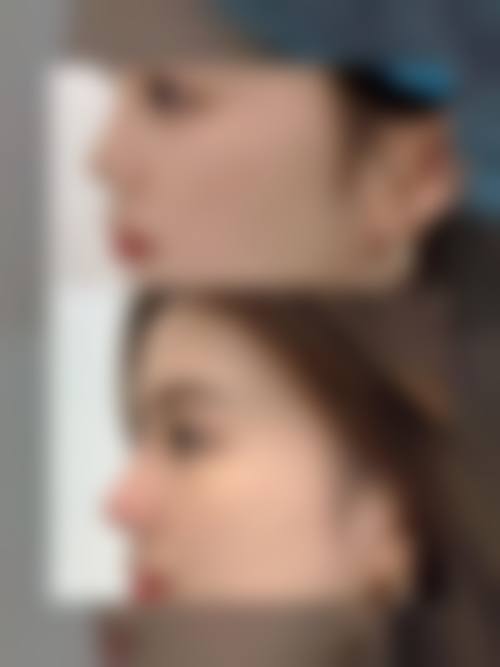 太原麦西整形美容门诊部口碑怎么样