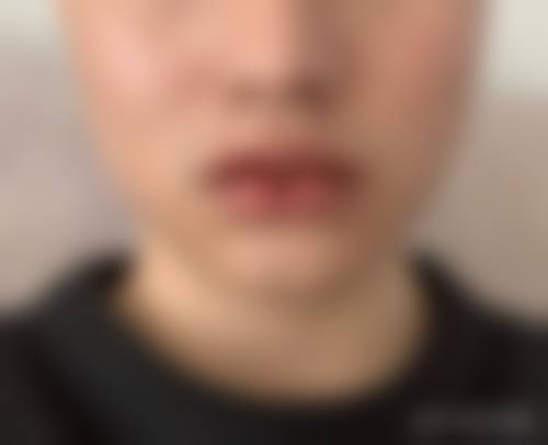 为什么要选择深圳沃德添美医疗美容诊所?