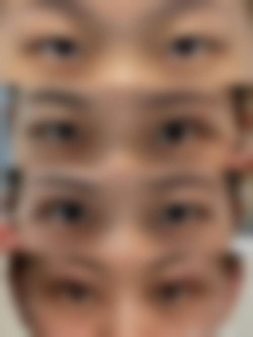 益阳格莱美整形医院收费价格表