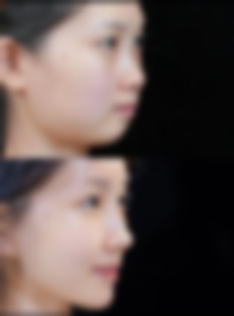 太原麦西整形美容门诊部收费价格表