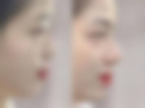 天津悦美整形医院是正规的吗/怎么样/靠谱吗