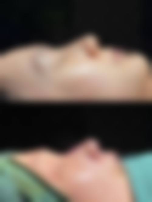 3. 刘兴振的临床实战与真实实例