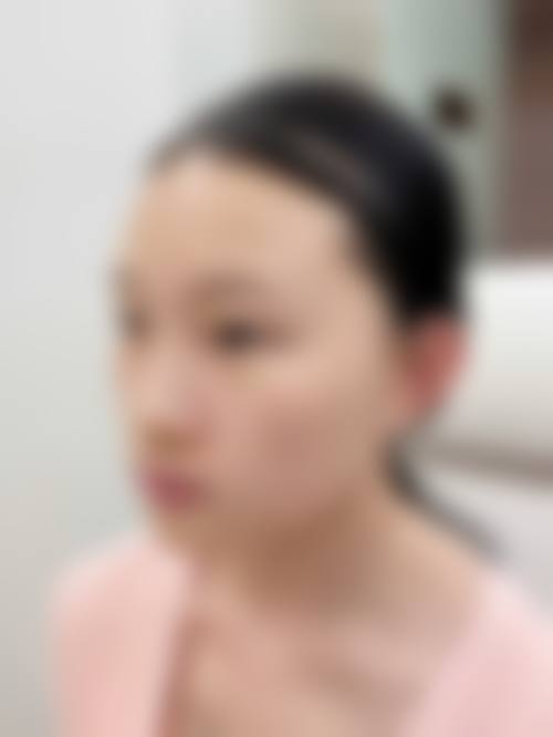 东莞时光医疗美容口碑怎么样