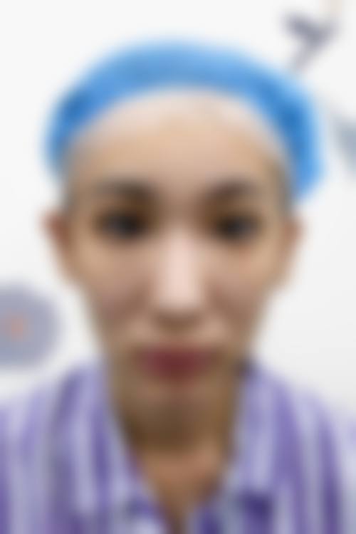 东港挚颜整形医院是正规的吗/怎么样/靠谱吗