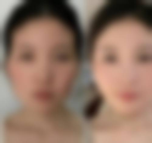 郑州薛正钦整形医疗美容诊所是正规的吗