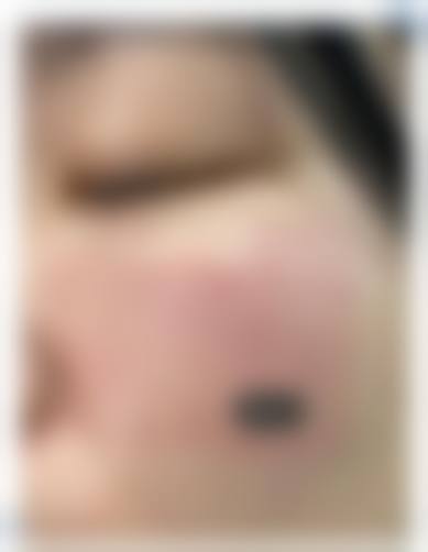 东莞新安医院医学整形科特色项目及技术优势