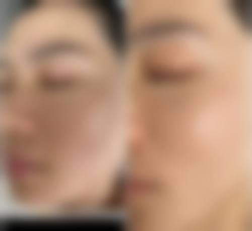 为什么要选择韩国Bitchaewoon皮肤科?