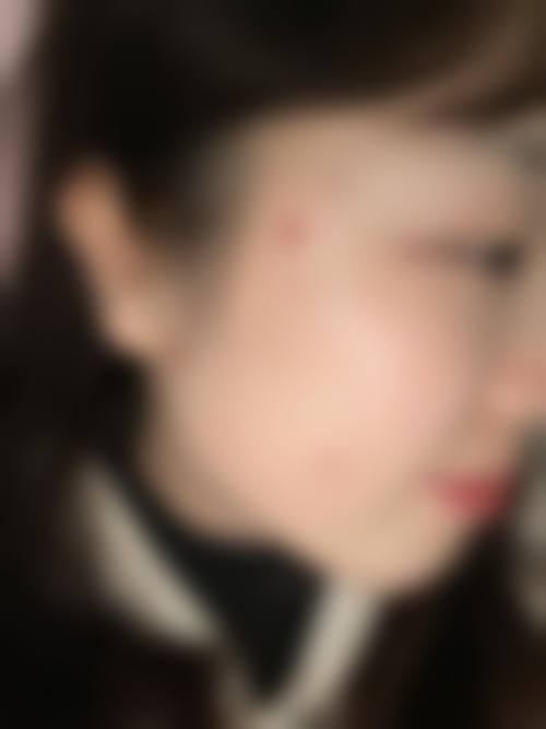 为什么要选择苏州市第五人民医院整形外科？