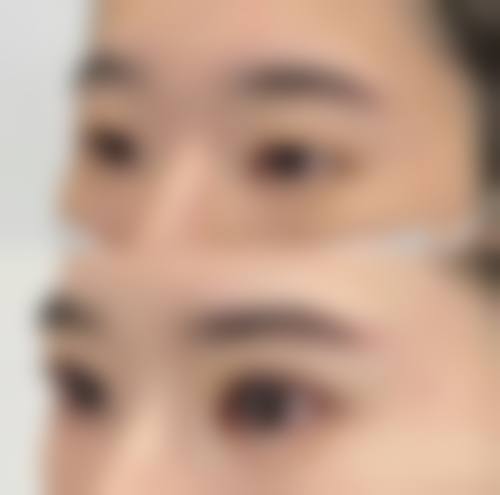 宜春悦颜整形医院收费价格表