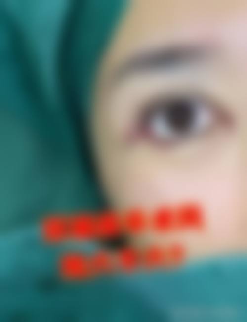 南充衡美医疗美容门诊部是正规的吗/怎么样/靠谱吗