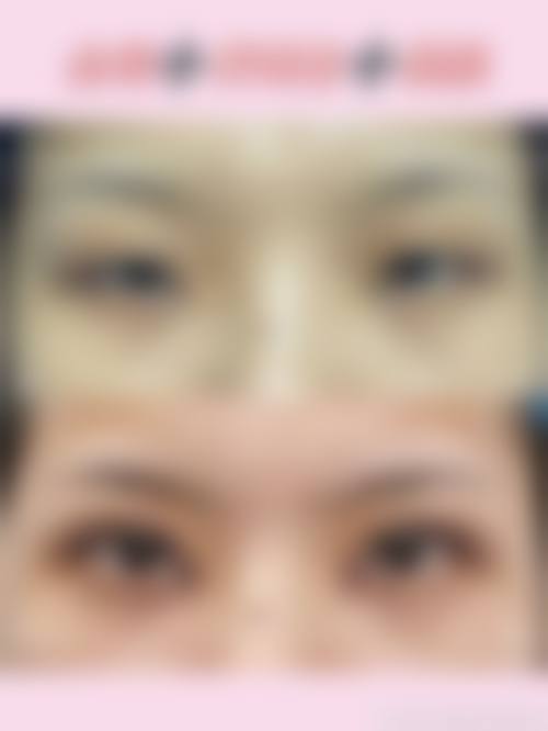 济南历下妙龄医美整形医院收费价格表