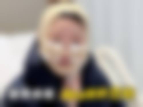 韩国NYPS整形外科医院怎么样预约挂号