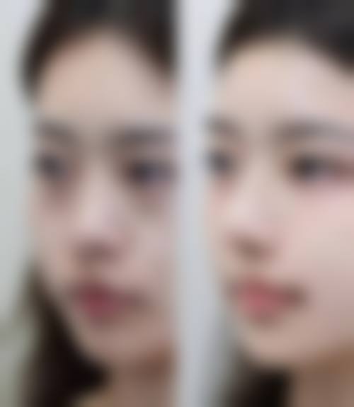 为什么要选择秦皇岛华韩医疗美容诊所?
