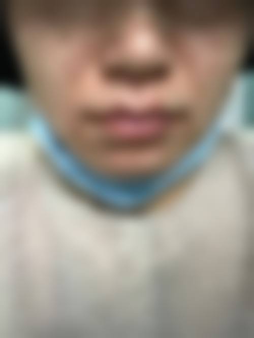 汉中时光整形美容医院口碑怎么样