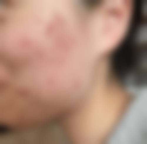为什么要选择威海致美专科门诊?