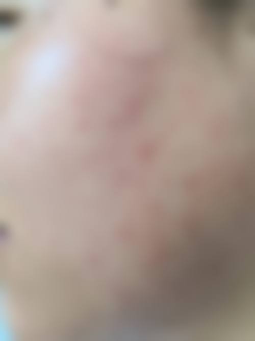 邯郸纺织有限公司职工医院是正规的吗