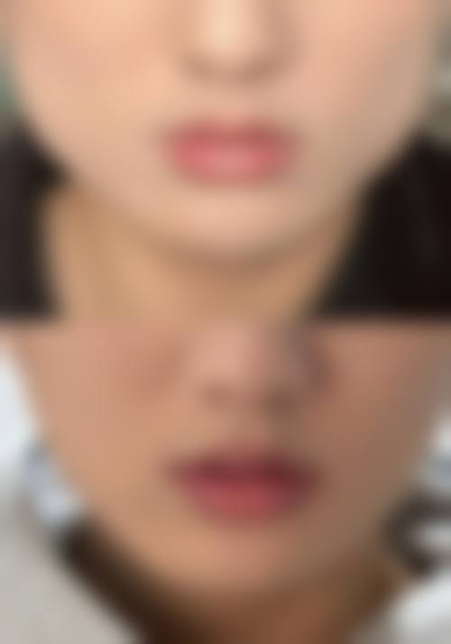 厦门集美慕一医疗美容门诊部口碑怎么样