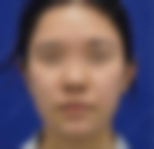 常州华 山整形美容医院收费价格表