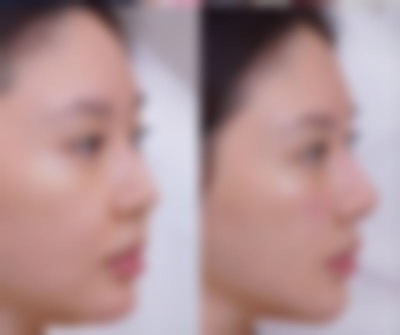 为什么要选择眉山栖上溪美医疗美容诊所？